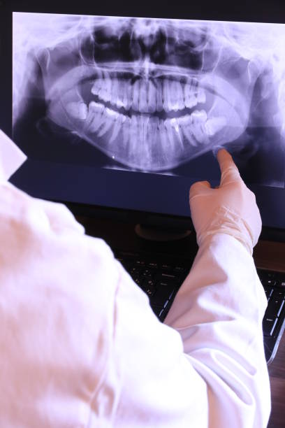 Best Dental Abscess Treatment in Haslett, MI