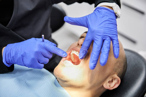 Best Knocked-Out Tooth (Avulsed Tooth) Treatment in Haslett, MI